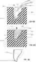 Fig. 33 - Method for forming bis-acrylic or other crown