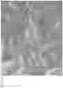 Fig. 12 - APPARATUS AND METHODS FOR TREATING ROOT CANALS OF TEETH