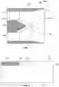 Fig. 04 - Graft having at least one woven taper