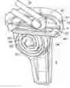Fig. 01 - Ligament assembly