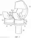 Fig. 02 - Ligament assembly