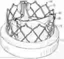 Fig. 01 - Systems and methods for sizing and implanting prosthetic heart valves