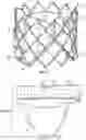 Fig. 06 - Systems and methods for sizing and implanting prosthetic heart valves