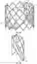 Fig. 09 - Systems and methods for sizing and implanting prosthetic heart valves