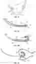 Fig. 10 - Systems and methods for sizing and implanting prosthetic heart valves