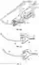Fig. 11 - Systems and methods for sizing and implanting prosthetic heart valves