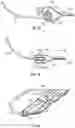 Fig. 12 - Systems and methods for sizing and implanting prosthetic heart valves