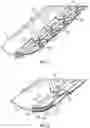 Fig. 13 - Systems and methods for sizing and implanting prosthetic heart valves