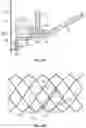 Fig. 15 - Systems and methods for sizing and implanting prosthetic heart valves