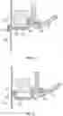 Fig. 16 - Systems and methods for sizing and implanting prosthetic heart valves