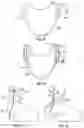 Fig. 20 - Systems and methods for sizing and implanting prosthetic heart valves