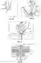 Fig. 21 - Systems and methods for sizing and implanting prosthetic heart valves