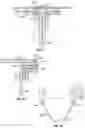 Fig. 22 - Systems and methods for sizing and implanting prosthetic heart valves