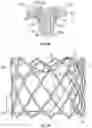 Fig. 26 - Systems and methods for sizing and implanting prosthetic heart valves