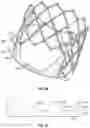Fig. 27 - Systems and methods for sizing and implanting prosthetic heart valves