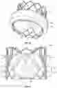 Fig. 28 - Systems and methods for sizing and implanting prosthetic heart valves