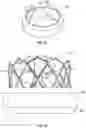 Fig. 30 - Systems and methods for sizing and implanting prosthetic heart valves