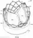 Fig. 31 - Systems and methods for sizing and implanting prosthetic heart valves
