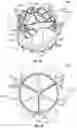 Fig. 38 - Systems and methods for sizing and implanting prosthetic heart valves
