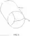 Fig. 02 - PERCUTANEOUSLY IMPLANTABLE REPLACEMENT HEART VALVE DEVICE AND METHOD OF MAKING SAME