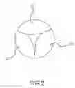 Fig. 03 - PERCUTANEOUSLY IMPLANTABLE REPLACEMENT HEART VALVE DEVICE AND METHOD OF MAKING SAME