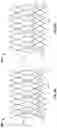 Fig. 08 - Prosthetic heart valve with paravalvular leak mitigation features