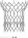 Fig. 13 - Prosthetic heart valve with paravalvular leak mitigation features