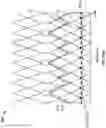Fig. 16 - Prosthetic heart valve with paravalvular leak mitigation features