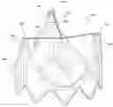Fig. 01 - DURABLE HIGH STRENGTH POLYMER COMPOSITES SUITABLE FOR PROSTHETIC VALVES