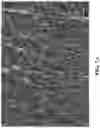 Fig. 09 - DURABLE HIGH STRENGTH POLYMER COMPOSITES SUITABLE FOR PROSTHETIC VALVES