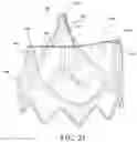 Fig. 25 - DURABLE HIGH STRENGTH POLYMER COMPOSITES SUITABLE FOR PROSTHETIC VALVES