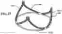 Fig. 27 - DURABLE HIGH STRENGTH POLYMER COMPOSITES SUITABLE FOR PROSTHETIC VALVES