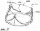 Fig. 29 - DURABLE HIGH STRENGTH POLYMER COMPOSITES SUITABLE FOR PROSTHETIC VALVES
