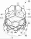 Fig. 01 - Prosthetic heart valve