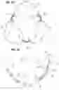 Fig. 09 - Prosthetic heart valve