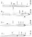 Fig. 03 - SYSTEMS, METHODS AND DEVICES FOR RETROGRADE PERICARDIAL RELEASE OF A PROSTHETIC HEART VALVE