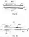 Fig. 05 - SYSTEMS, METHODS AND DEVICES FOR RETROGRADE PERICARDIAL RELEASE OF A PROSTHETIC HEART VALVE