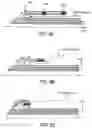 Fig. 09 - SYSTEMS, METHODS AND DEVICES FOR RETROGRADE PERICARDIAL RELEASE OF A PROSTHETIC HEART VALVE