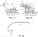 Fig. 04 - METHODS AND DEVICES FOR VENTRICULAR RESHAPING AND HEART VALVE RESHAPING