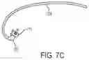 Fig. 14 - METHODS AND DEVICES FOR VENTRICULAR RESHAPING AND HEART VALVE RESHAPING