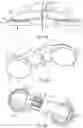Fig. 16 - METHODS AND DEVICES FOR VENTRICULAR RESHAPING AND HEART VALVE RESHAPING