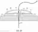 Fig. 18 - METHODS AND DEVICES FOR VENTRICULAR RESHAPING AND HEART VALVE RESHAPING