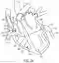 Fig. 31 - METHODS AND DEVICES FOR VENTRICULAR RESHAPING AND HEART VALVE RESHAPING