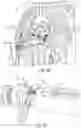 Fig. 35 - METHODS AND DEVICES FOR VENTRICULAR RESHAPING AND HEART VALVE RESHAPING