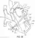 Fig. 40 - METHODS AND DEVICES FOR VENTRICULAR RESHAPING AND HEART VALVE RESHAPING