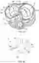 Fig. 47 - METHODS AND DEVICES FOR VENTRICULAR RESHAPING AND HEART VALVE RESHAPING