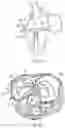 Fig. 50 - METHODS AND DEVICES FOR VENTRICULAR RESHAPING AND HEART VALVE RESHAPING