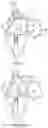 Fig. 55 - METHODS AND DEVICES FOR VENTRICULAR RESHAPING AND HEART VALVE RESHAPING