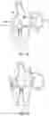 Fig. 57 - METHODS AND DEVICES FOR VENTRICULAR RESHAPING AND HEART VALVE RESHAPING