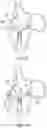 Fig. 61 - METHODS AND DEVICES FOR VENTRICULAR RESHAPING AND HEART VALVE RESHAPING